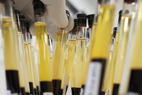 El suero es plasma menos los factores de coagulación